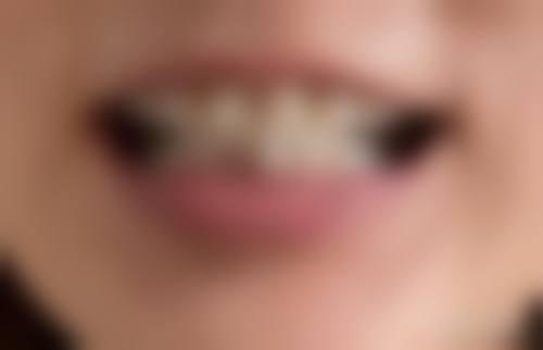 预约优惠活动