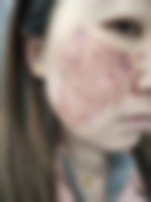 总结:选择正规机构,安心变得更美从这里开始