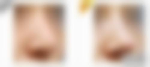 擅长项目详解