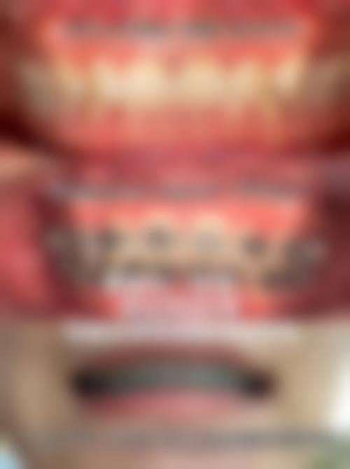 总结:专精的口腔管理,从此开始