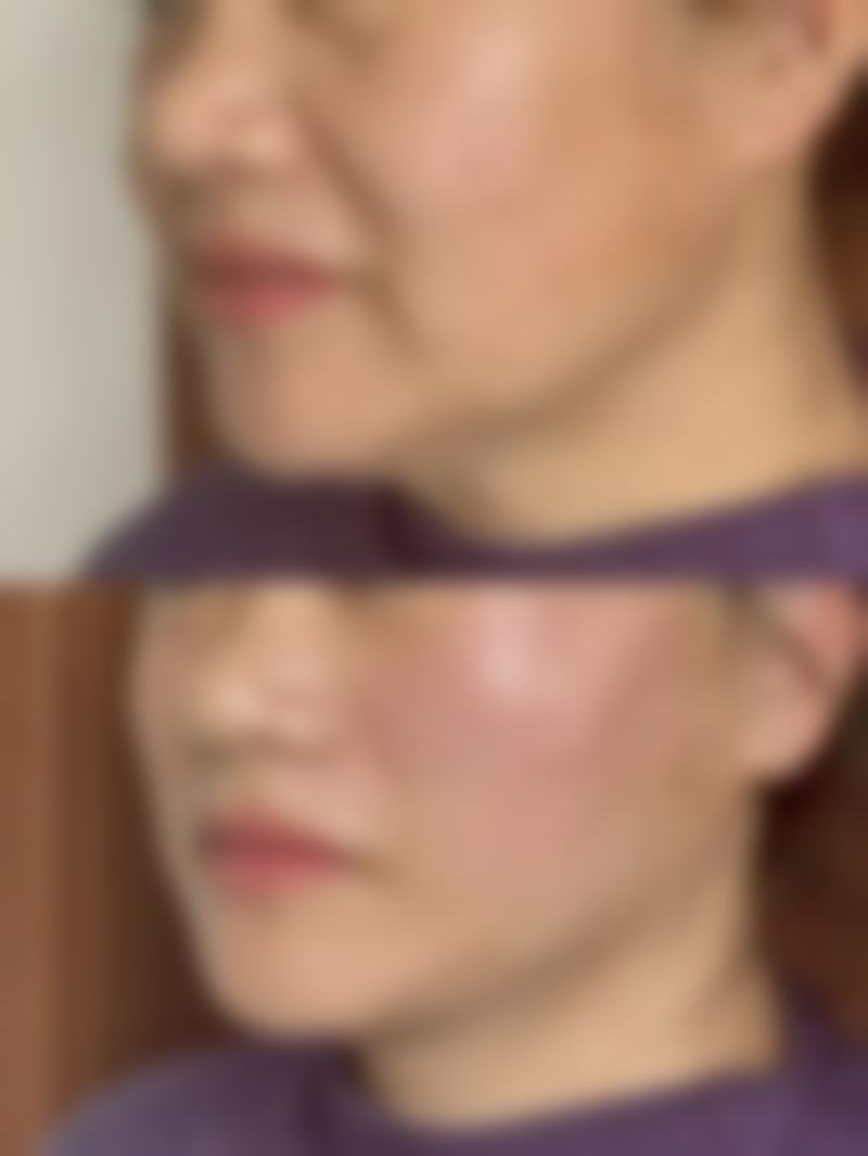 临床实例分享