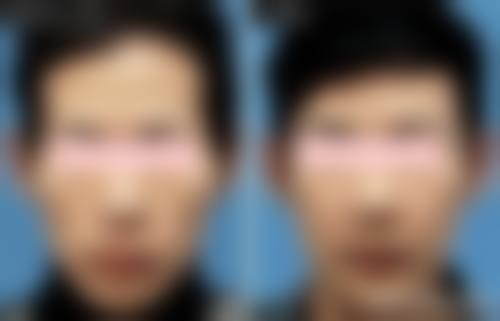 常见问题解答