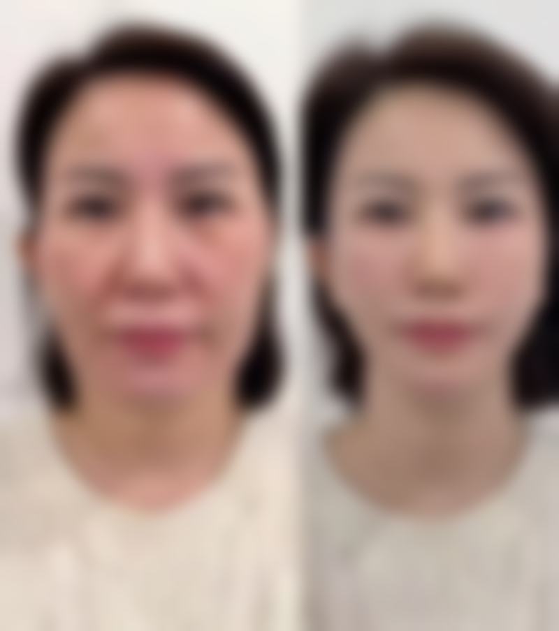 北京桂莹医疗美容医院口碑好评：真实反馈，值得信赖